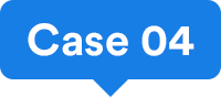 Case 04